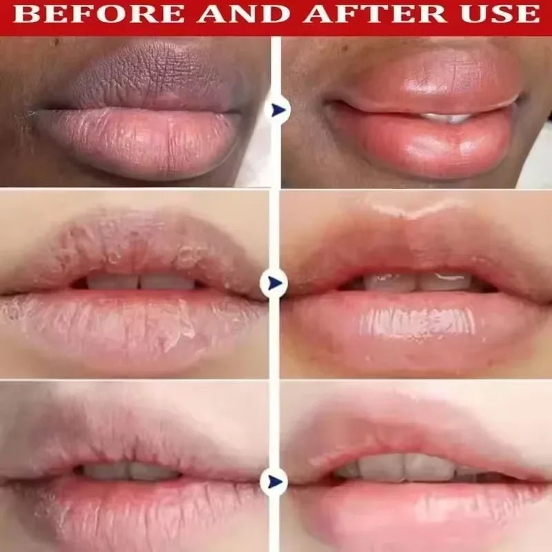 Nourishing Lip Mask & Balm for Dry Lips with Gentle Exfoliating Care - Velvet Haven