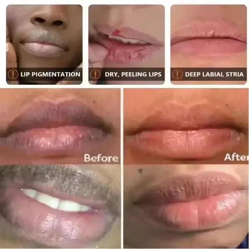Nourishing Lip Mask & Balm for Dry Lips with Gentle Exfoliating Care - Velvet Haven