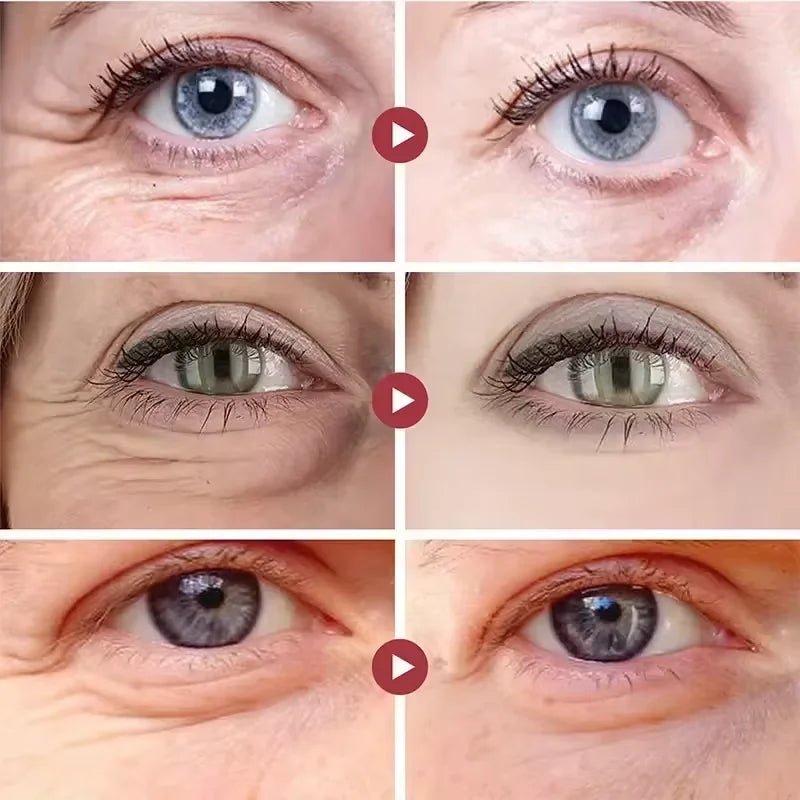 Instant Eye Bag Remove Cream Retinol Anti-Wrinkle Firming Skin Fade Fine Lines Anti Dark Circle Puffiness Brighten Eye SkinCare - Velvet Haven