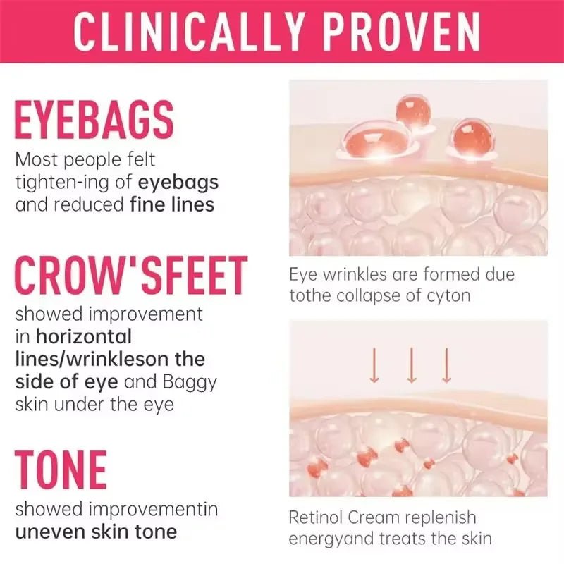 Instant Eye Bag Remove Cream Retinol Anti-Wrinkle Firming Skin Fade Fine Lines Anti Dark Circle Puffiness Brighten Eye SkinCare - Velvet Haven